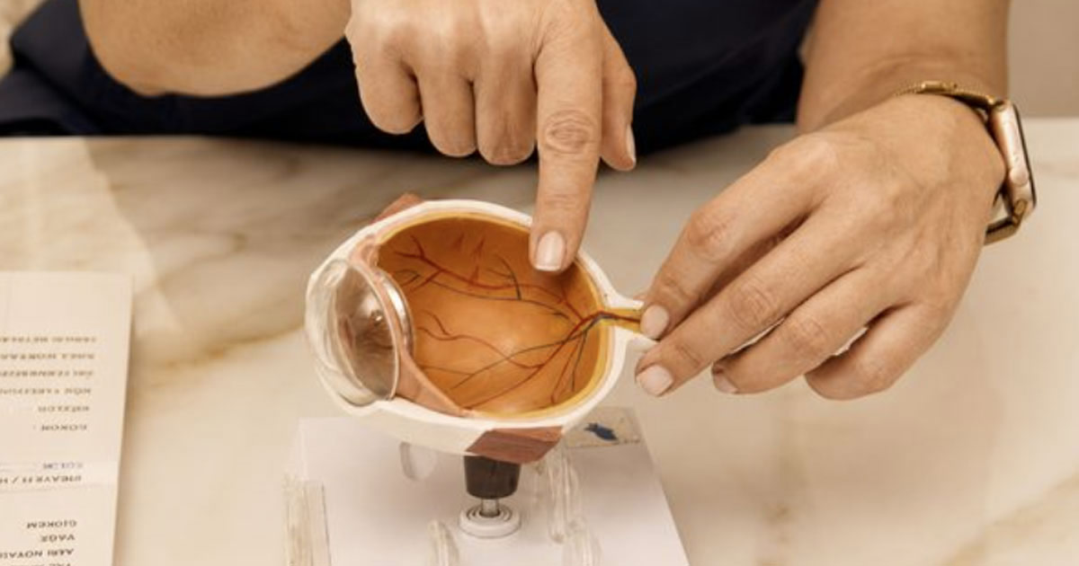 Vitrektomi cerrahisi öncesi: göz modeli üzerinden vitreus ve retina anatomisinin anlatılması